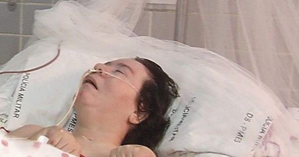 Unidentified Brazilian woman dies after 24 years in a coma
